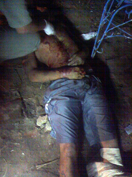 homicidio Un médico certifica la muerte de Espíndola, en el patio de su vecino.